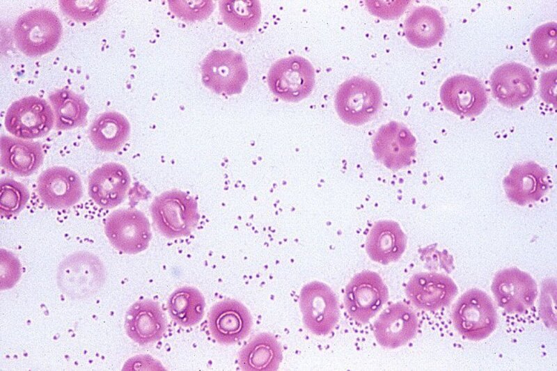 Vi khuẩn gram âm Pasteurella multoccia gây bệnh tụ huyết trùng ở gà chọi
